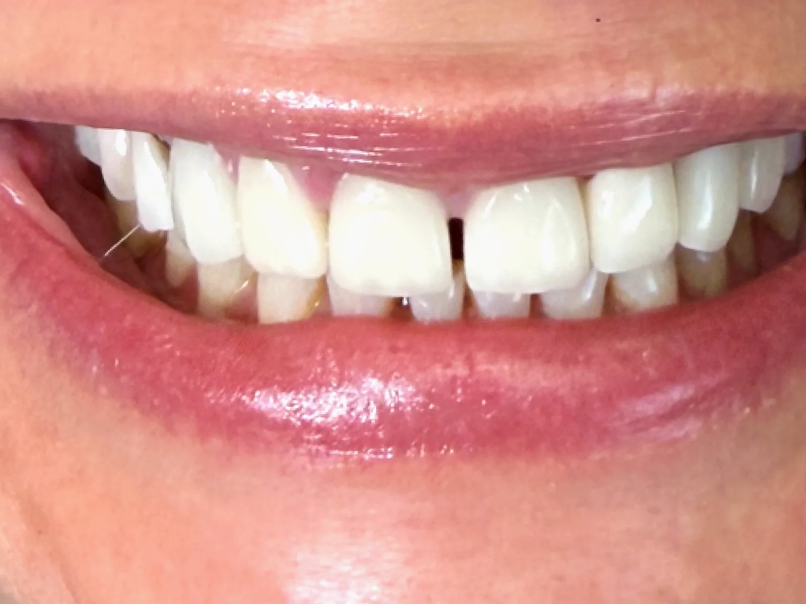 Cosmetic dentistry in Royal Oak at Serenity Family Dentistry